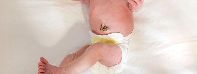 What to Know About Baby's Umbilical Cord Falling Off 