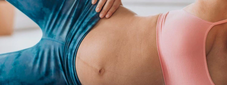 What is Linea Alba? Early Pregnancy Line on Stomach