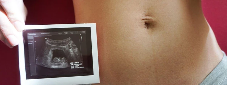 Your 11-Week Ultrasound: What to Expect & What You Can See
