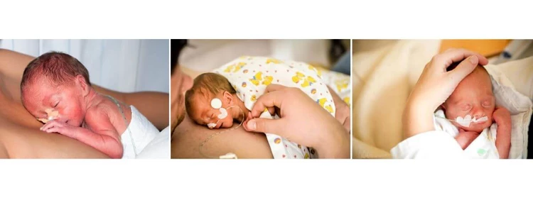 Baby born at 31 weeks pictures