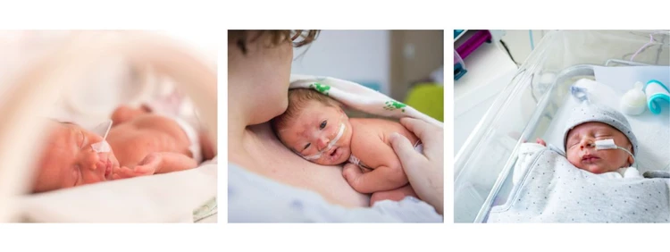 baby born at 35 weeks pictures