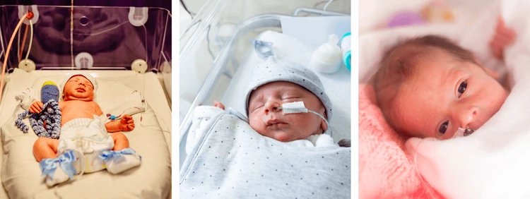 baby born at 36 weeks pictures