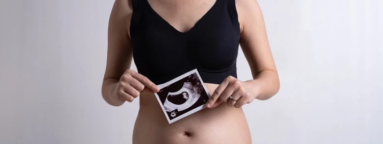 Tercer mes de embarazo: Qué esperar durante el embarazo