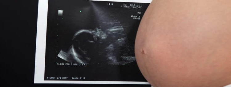 8-month-pregnant-sonogram