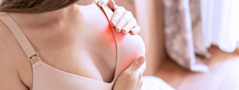 yeast-infection-under-breast