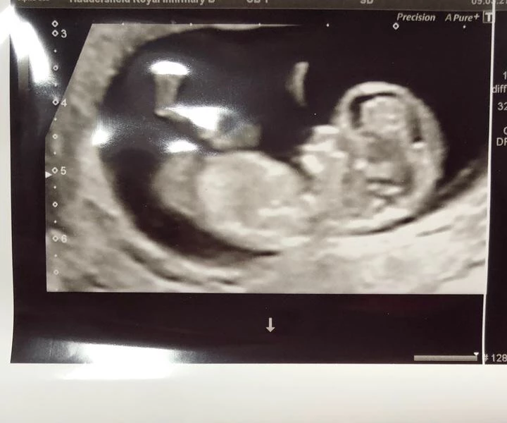 Baby’s brain really visible on scan